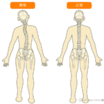 体の捻じれ