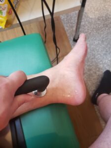 足首にインディバ 足首治療