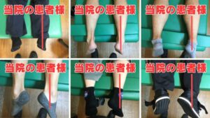 坐骨神経痛やってはいけないこと