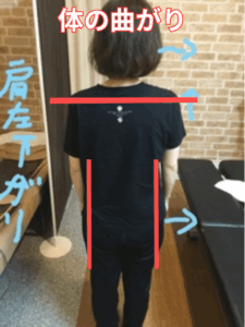 Body bending | 蕨重症専門 くまさんの整骨院 体の曲がり腰痛