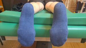 偏平足外反母趾