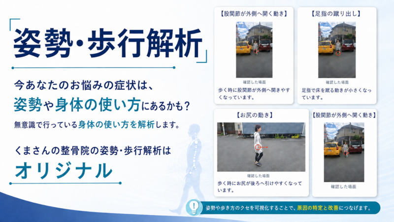 姿勢・歩行解析の案内。右側の4枚の写真カードは膝の外側開き、足指の蹴出し、お尻の動き、膝関節の外側開きを確認する場面を示す情報画像です。